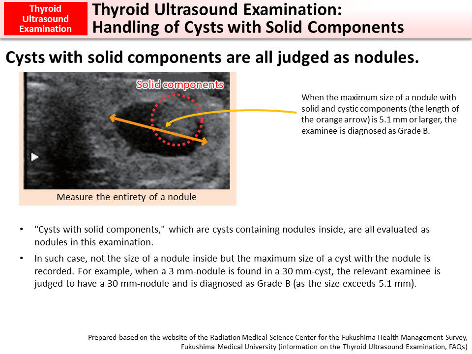 Thyroid Ultrasound Examination: Handling of Cysts with Solid Components_Figure