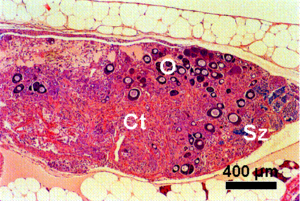 Testis-ova & connective tissue