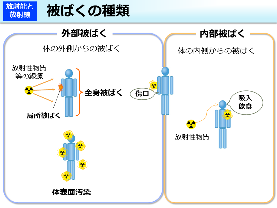 被ばくの種類