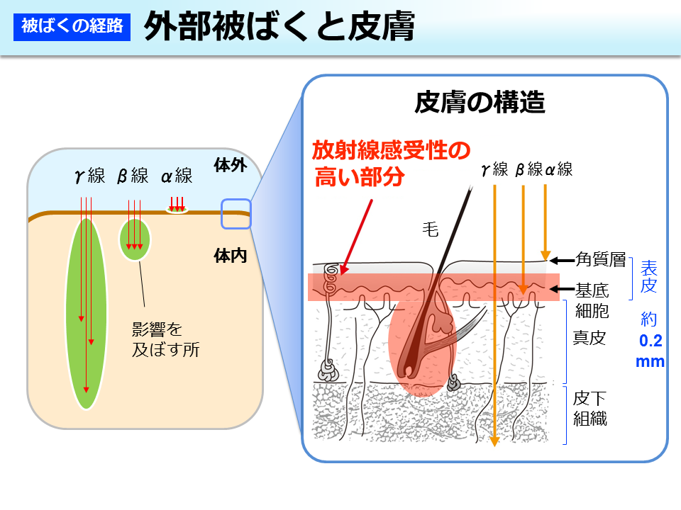 外部被ばくと皮膚