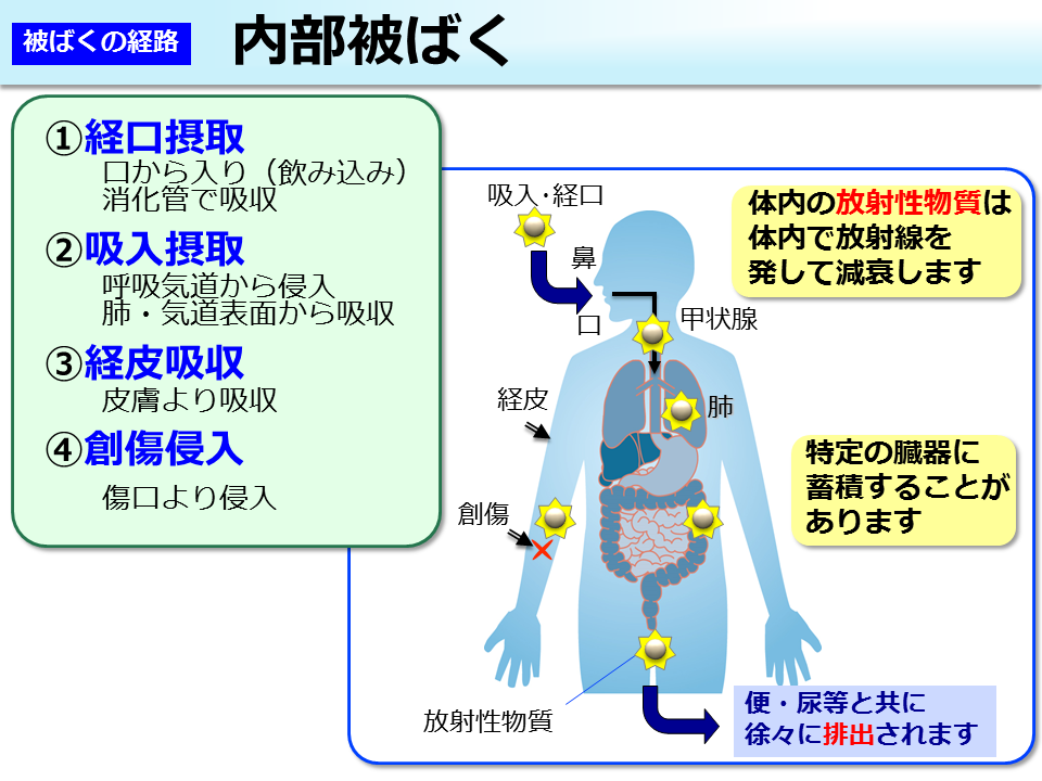 内部被ばく