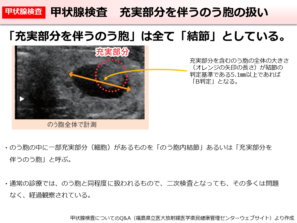 甲状腺検査 充実部分を伴うのう胞の扱い