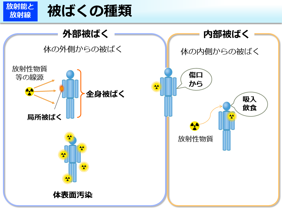 被ばくの種類