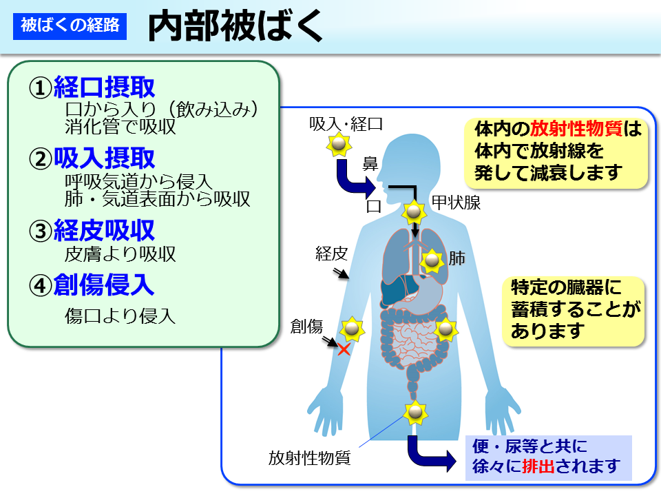 内部被ばく