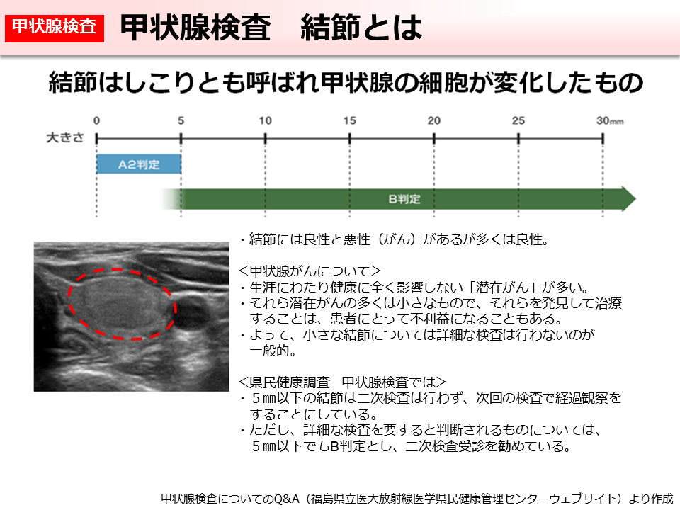 甲状腺検査 結節とは