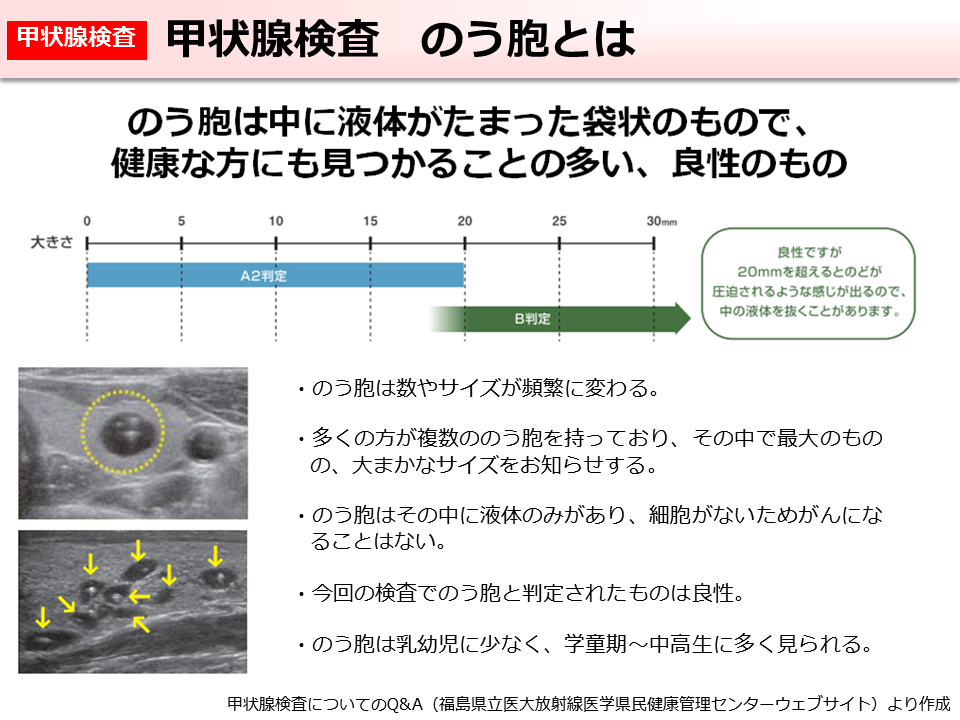 甲状腺検査 のう胞とは