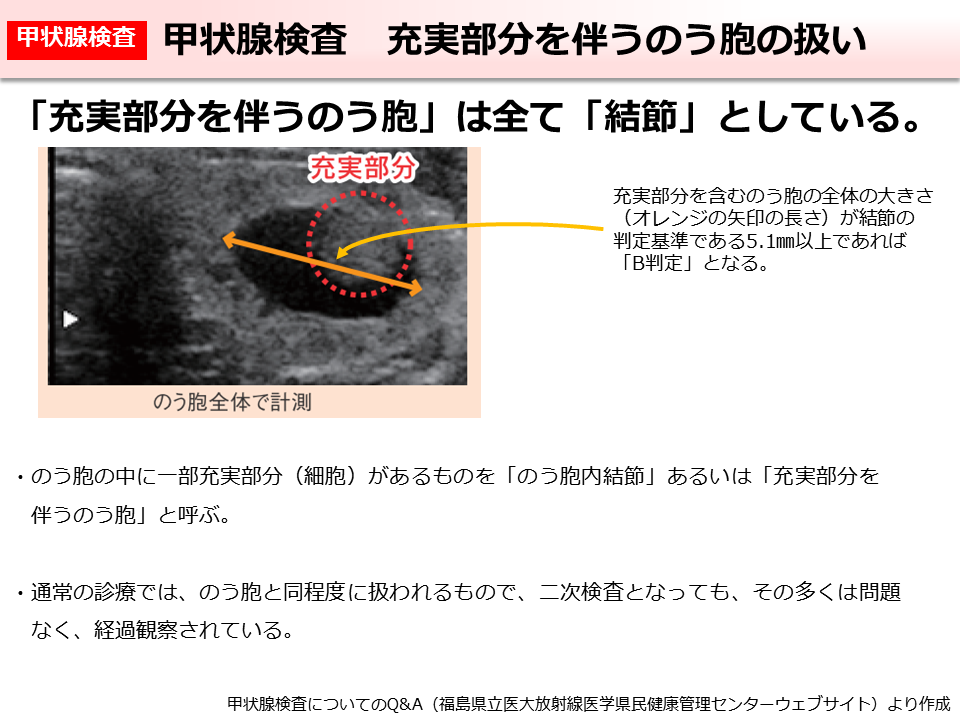 甲状腺検査 充実部分を伴うのう胞の扱い