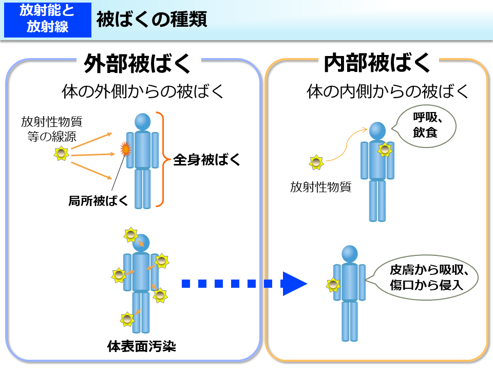 被ばくの種類