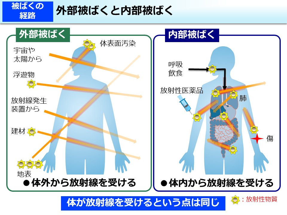 外部被ばくと内部被ばく