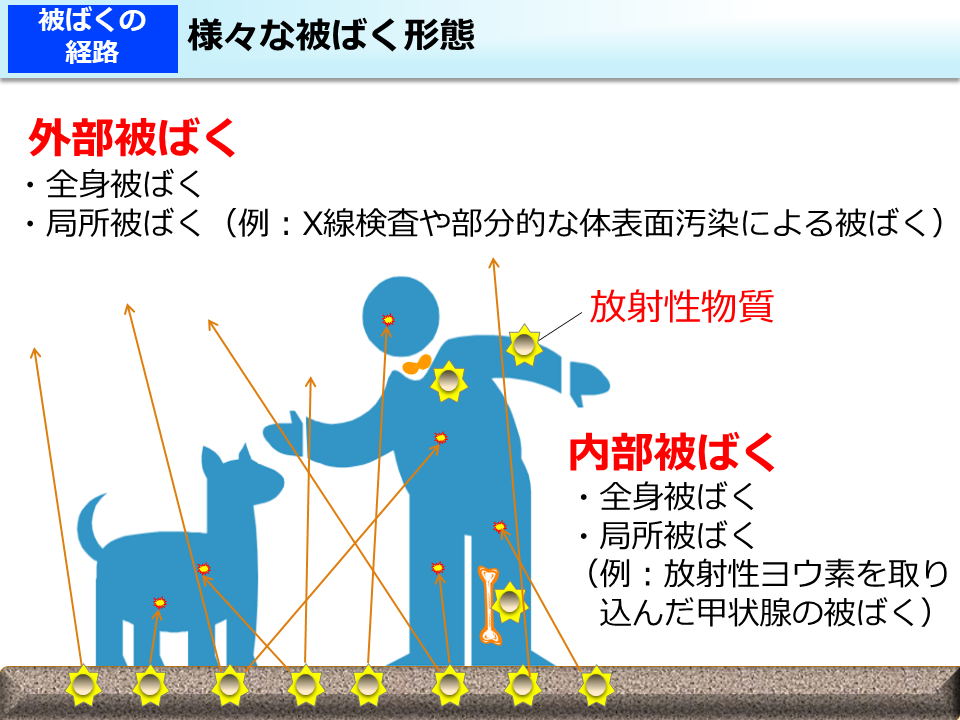 様々な被ばく形態