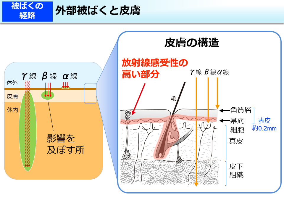 外部被ばくと皮膚