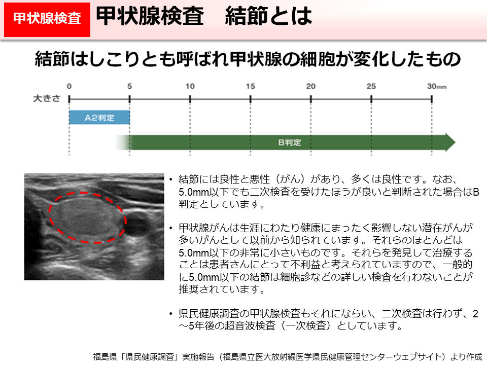 甲状腺検査　結節とは