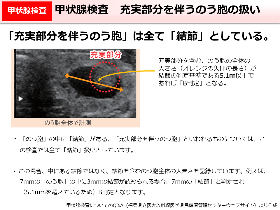 甲状腺検査　充実部分を伴うのう胞の扱い