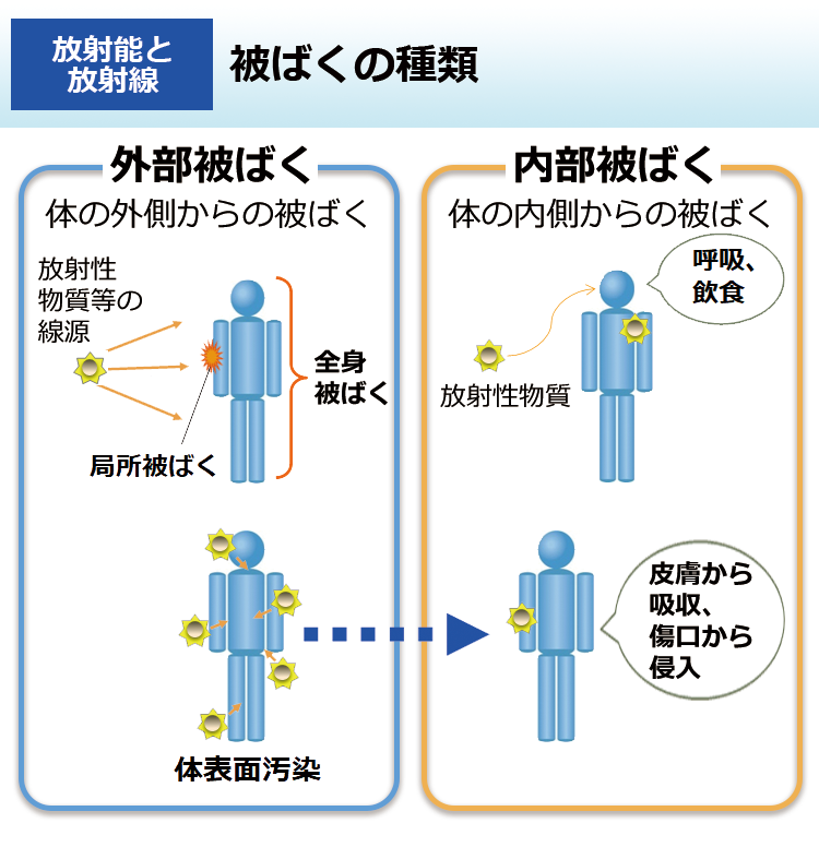 被ばくの種類