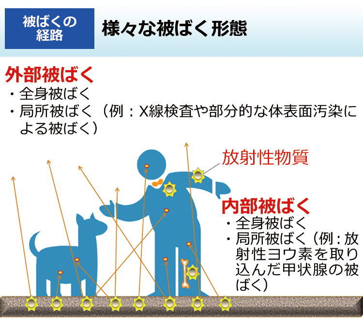 様々な被ばく形態