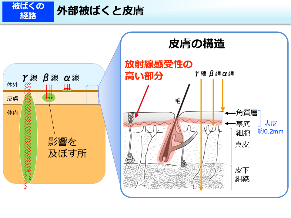外部被ばくと皮膚
