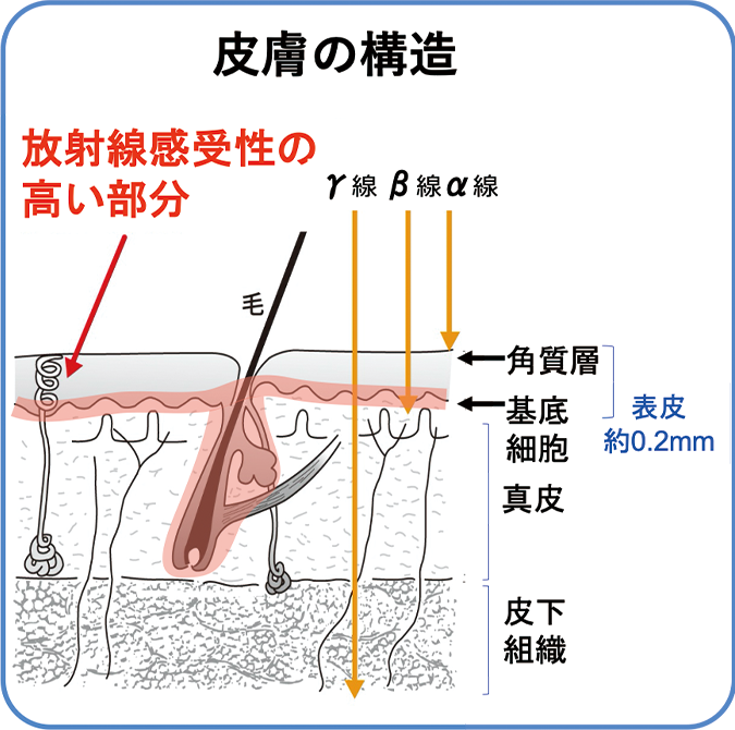 外部被ばくと皮膚