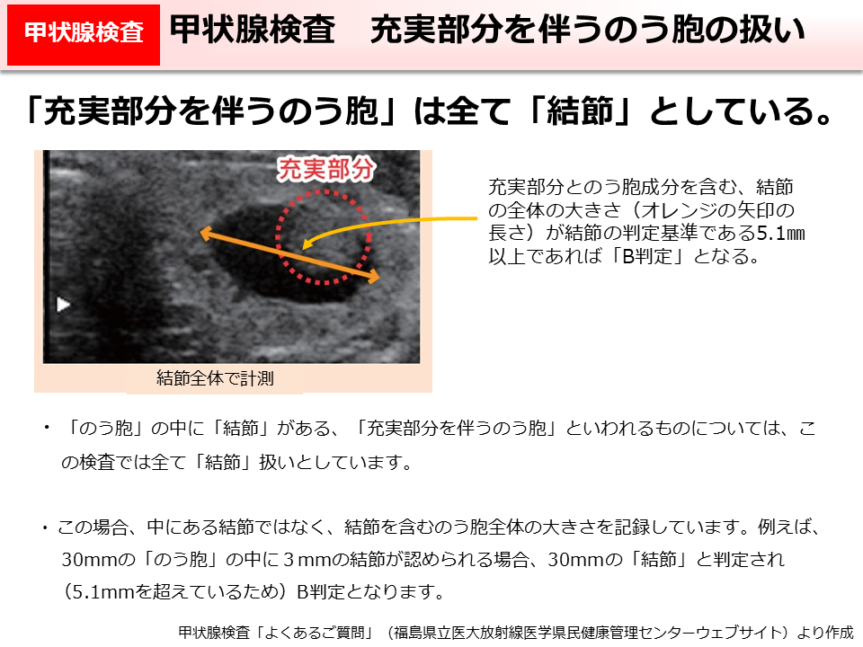 甲状腺検査　充実部分を伴うのう胞の扱い