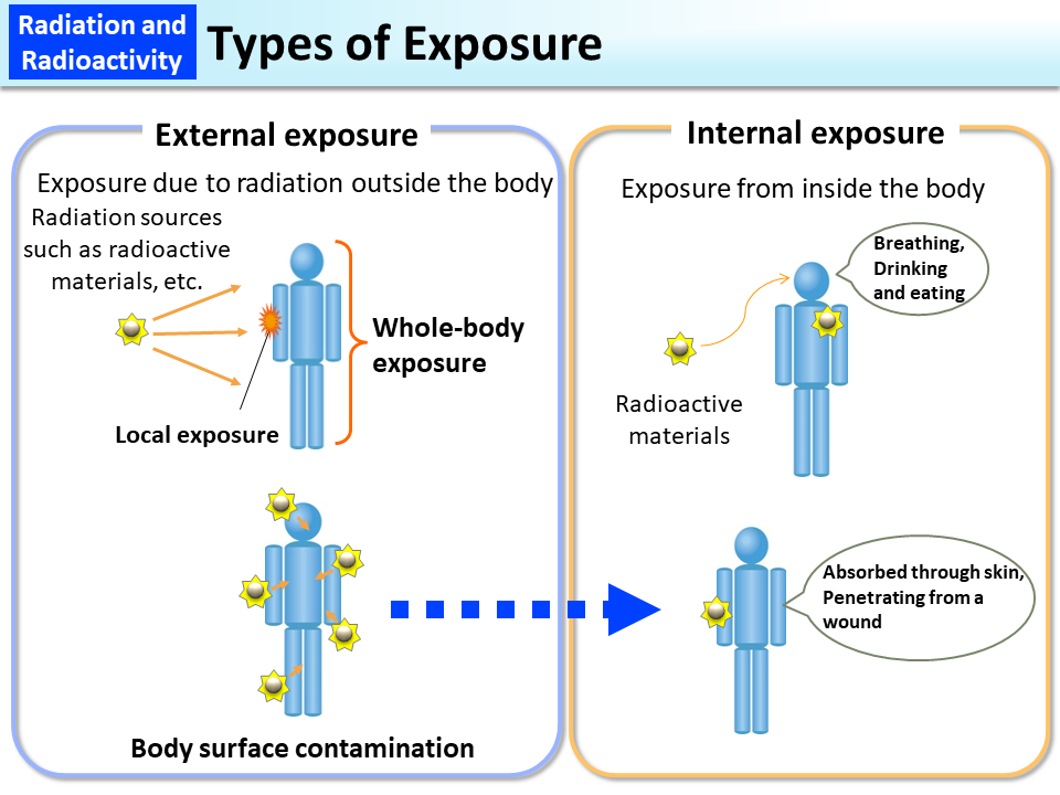 Types of Exposure_Figure