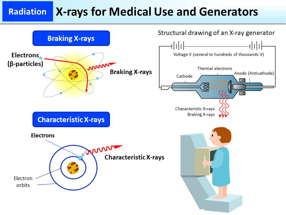 X-rays for Medical Use and Generators_Figure