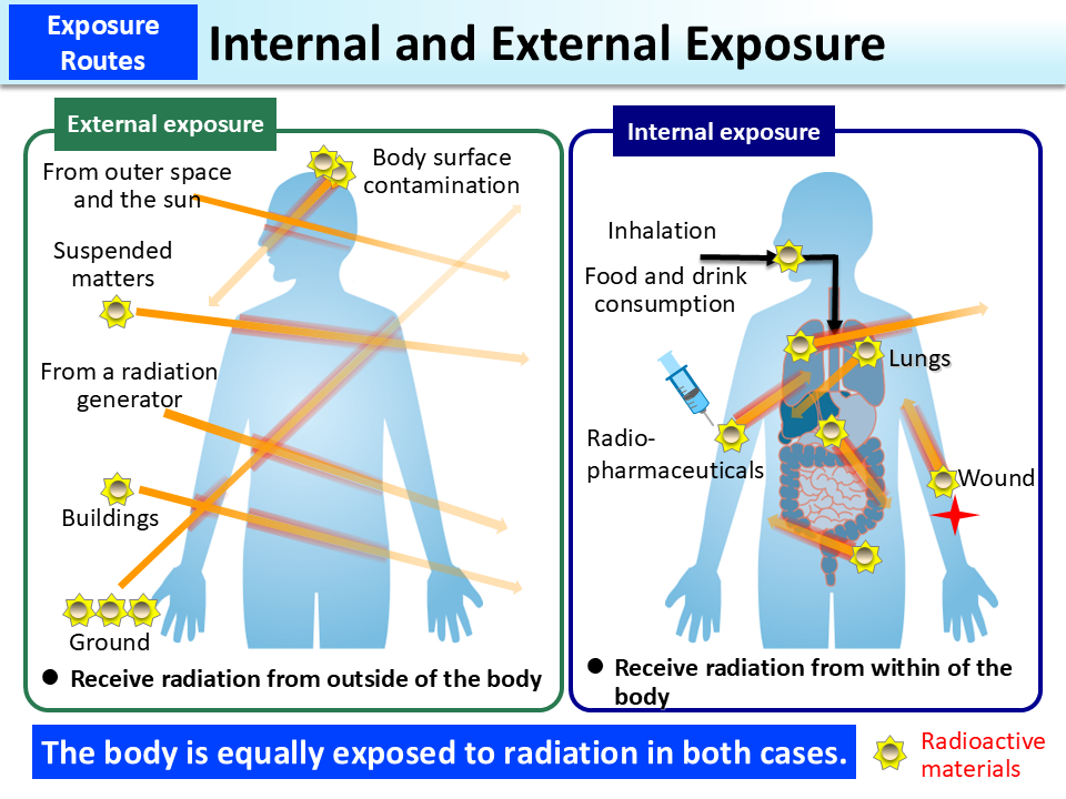 Internal and External Exposure [MOE]