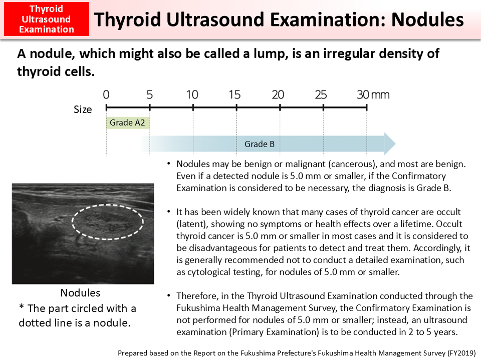 Thyroid Nodule Size Chart Mm