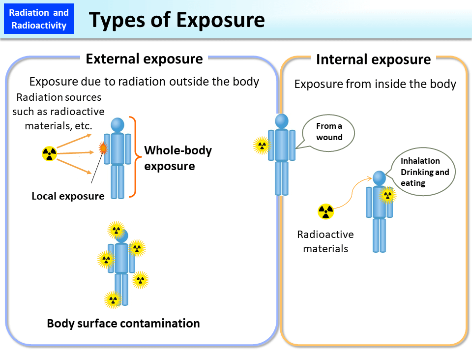 Types of Exposure_Figure