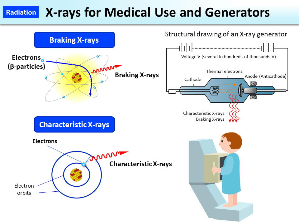 X-rays for Medical Use and Generators_Figure