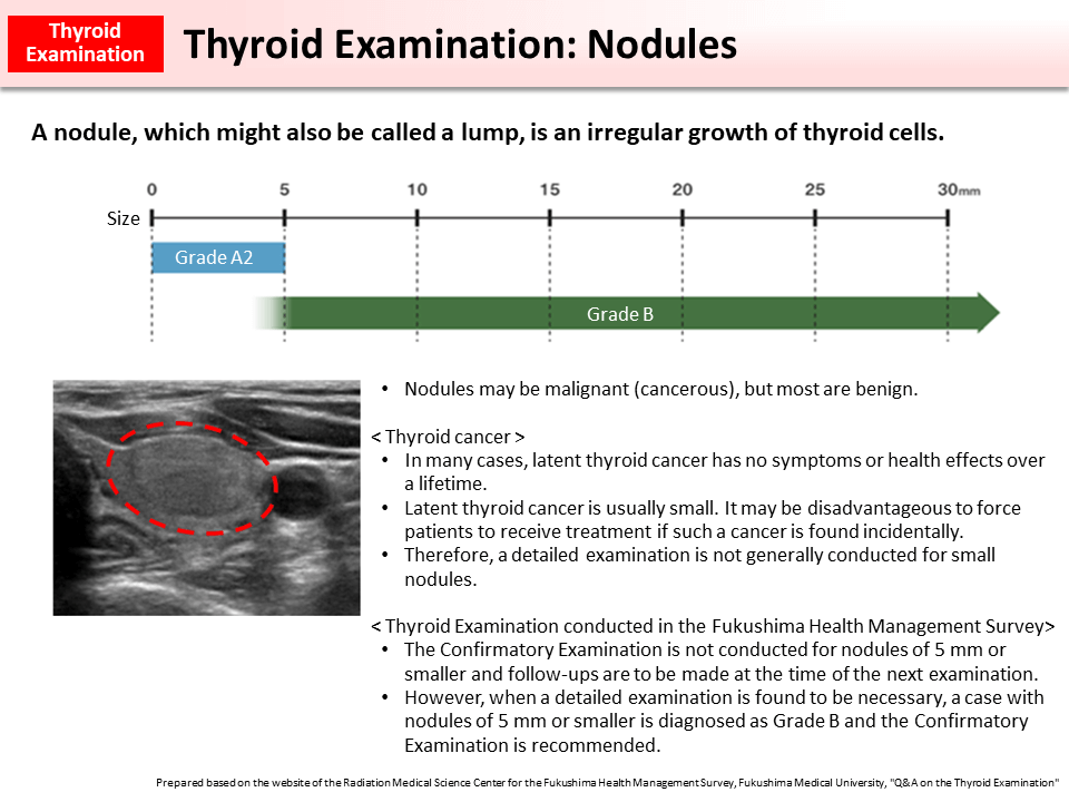 Thyroid Examination: Nodules_Figure