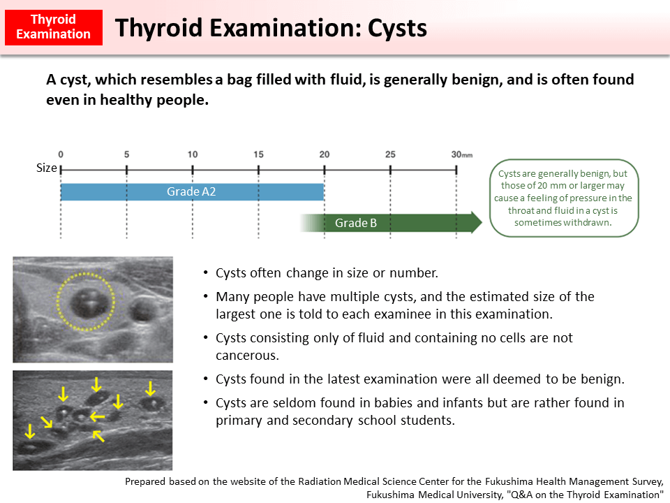 Thyroid Examination: Cysts_Figure