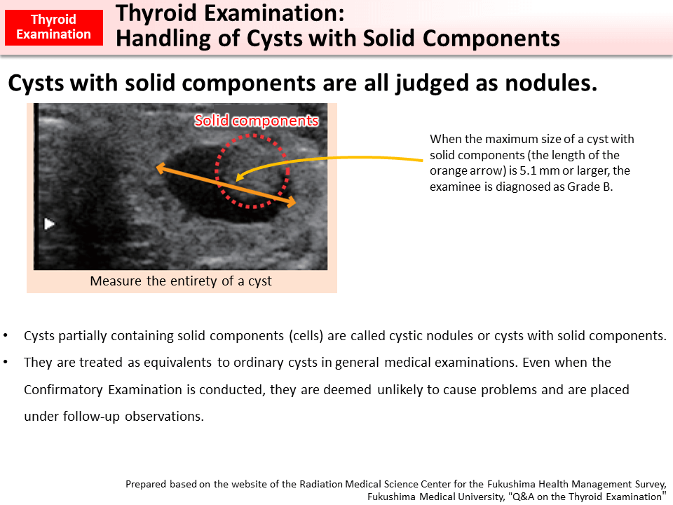 Thyroid Examination: Handling of Cysts with Solid Components_Figure