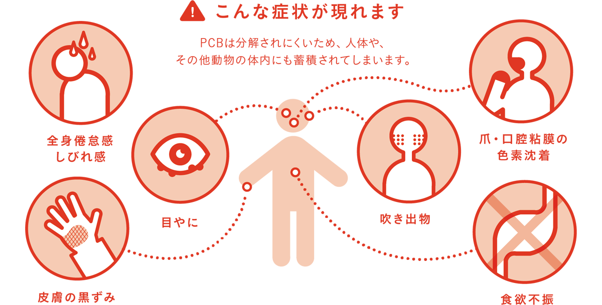 こんな症状が現れます／PCBは分解されにくいため、人体や、その他動物の体内にも蓄積されてしまいます。