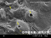 カエルツボカビの遊走子嚢